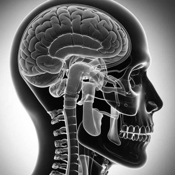 MR-XOTOX-NASSE-WAENDE-SDXL - v3.0