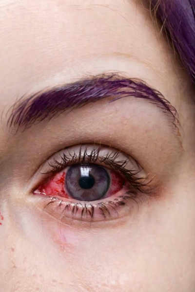 Perfect Eyes XL - V3_Bloodshot